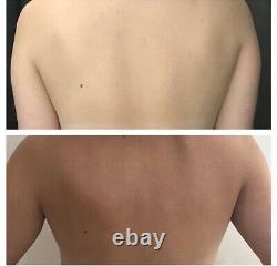 Kit de bronzage par pulvérisation, Dernier bronzage. Machine Lite, tente de pulvérisation et bronzage par pulvérisation! Prix de vente conseillé £300.00